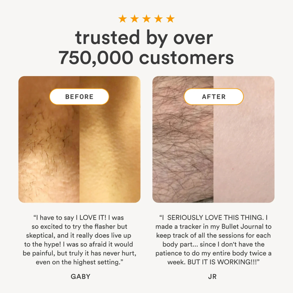 Nood Flasher 2.0 IPL Hair Removal Device – Pain-Free for Men & Women