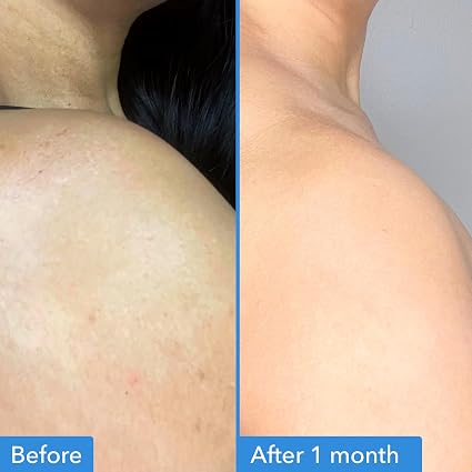 Good Molecules Discoloration Correcting Body Treatment with Niacinamide – 4 fl oz