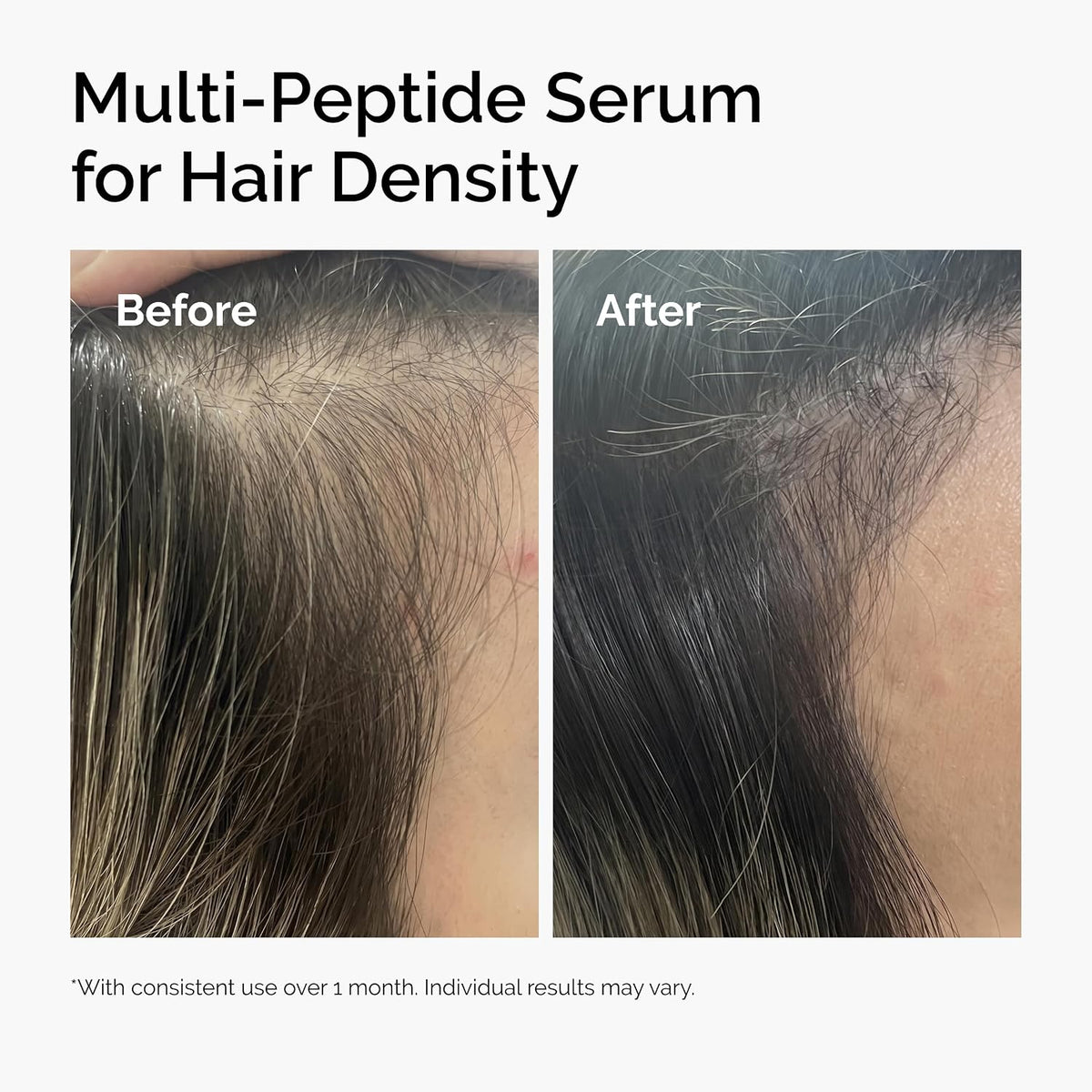 The Ordinary Multi-Peptide Serum for Hair Density – 2 fl oz / 60 mL