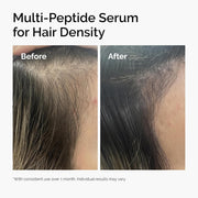 The Ordinary Multi-Peptide Serum for Hair Density – 2 fl oz / 60 mL