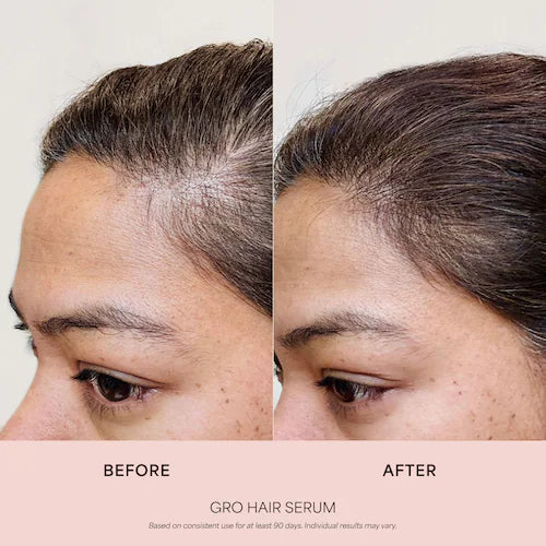 VEGAMOUR GRO Hair Serum for Thinning Hair – 1 fl oz / 30 mL