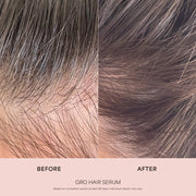 VEGAMOUR GRO Hair Serum for Thinning Hair – 1 fl oz / 30 mL